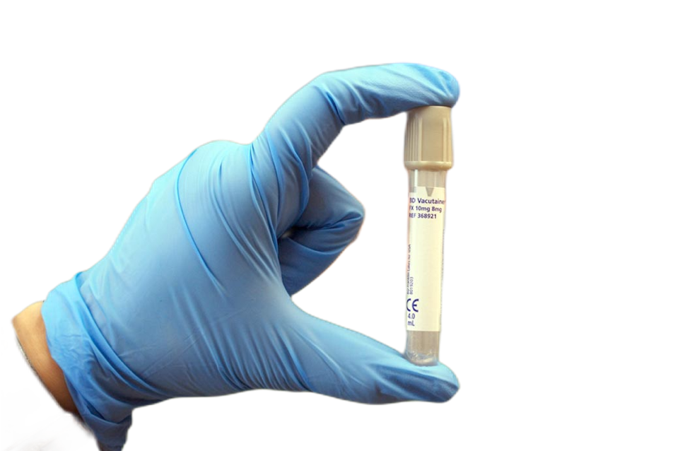 A medical gloved hand holding a vile of frozen semen between the thumb and fore finger.